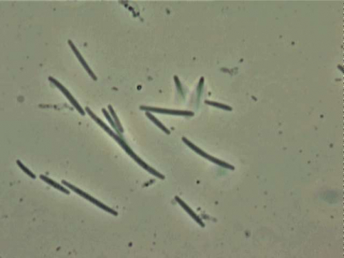Stigmatella-Microbialtec Research