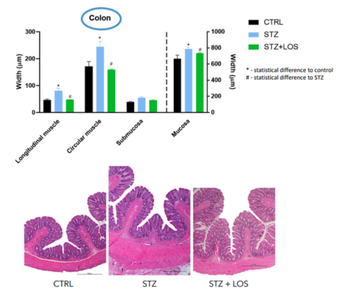ACEIS & ARAS: Repurposing existing drugs