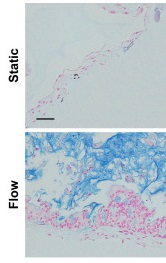Intestine-on-a-chip for Drug Metabolism and Infectious Disease Modeling